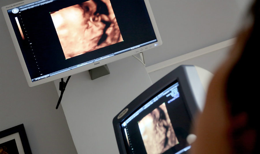 How Much Does an Ultrasound Machine Cost